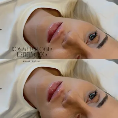 Kosmetologia Estetyczna Angie Pudło